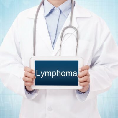 6 Facts About Non-Hodgkin’s Lymphoma