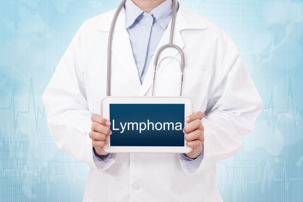 6 Facts About Non-Hodgkin’s Lymphoma