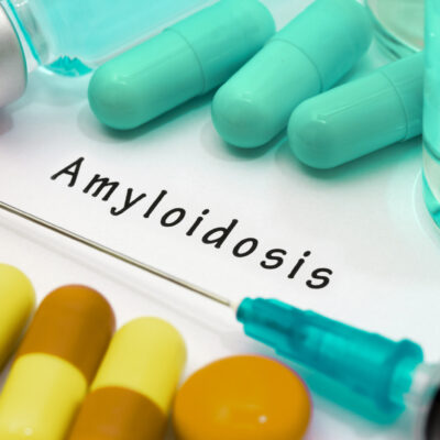 All About Amyloidosis and its Types