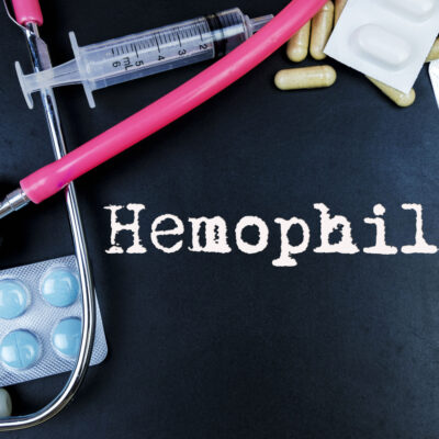 Approaches to Treating and Managing Hemophilia