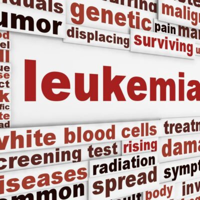 Leukemia Types and Risk Factors