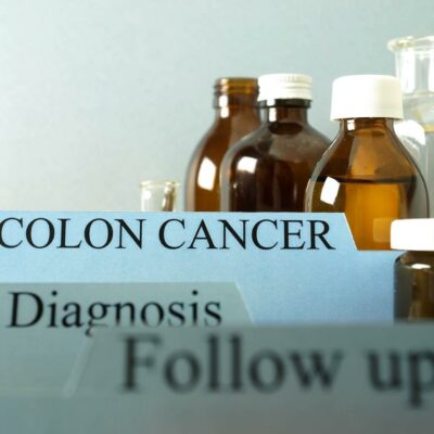 Must-Know Facts About Colon Cancer
