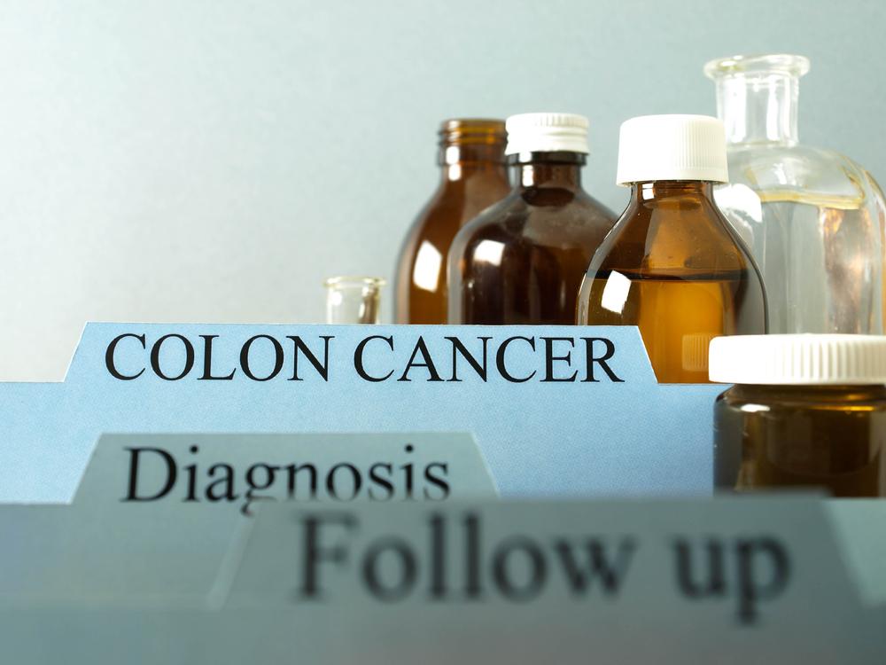 Must-Know Facts About Colon Cancer