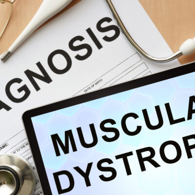 What to Know About Muscular Dystrophy Treatments