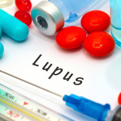 Tips to Lead a Better Life with Lupus