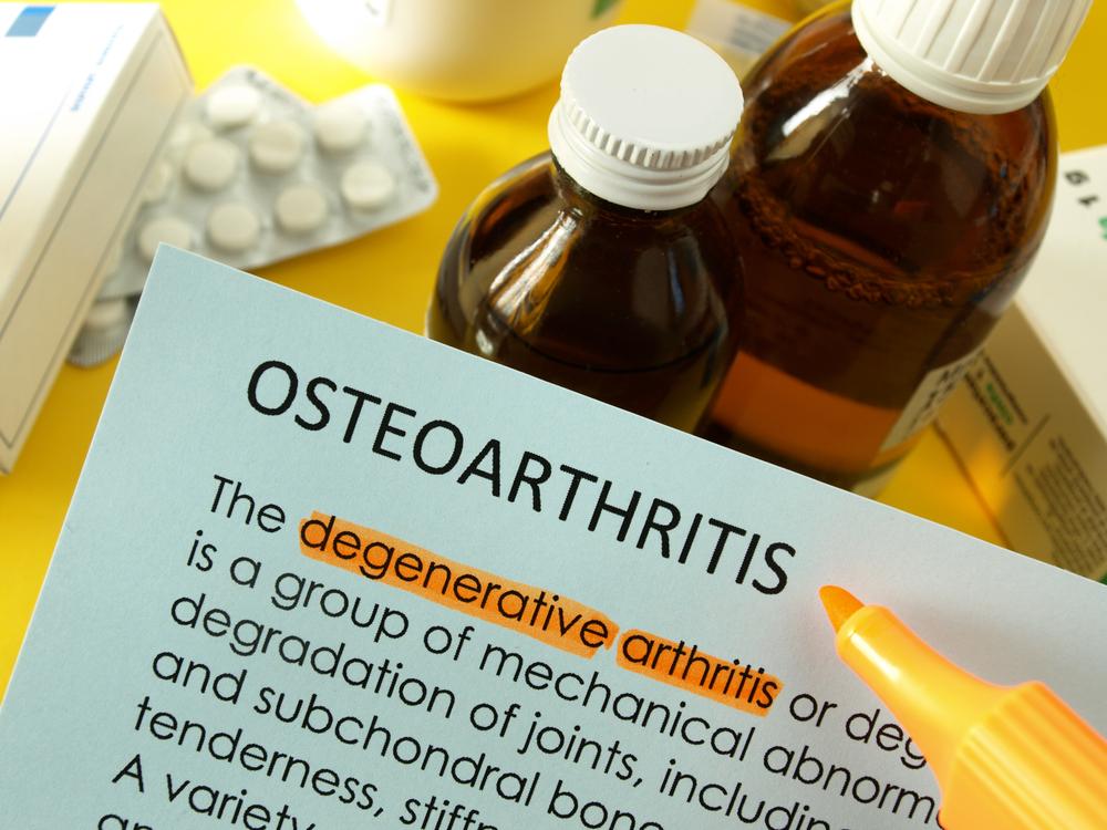 Lifestyle Changes for Osteoarthritis Pain